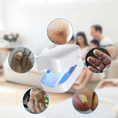 Tilas™ LightFix| Fototerapia para Uñas Dañadas