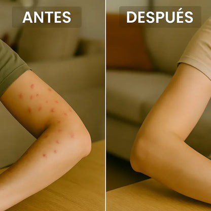 Pack 2 LAMPARAS ANTIMOSQUITOS ecológico ZenFly™